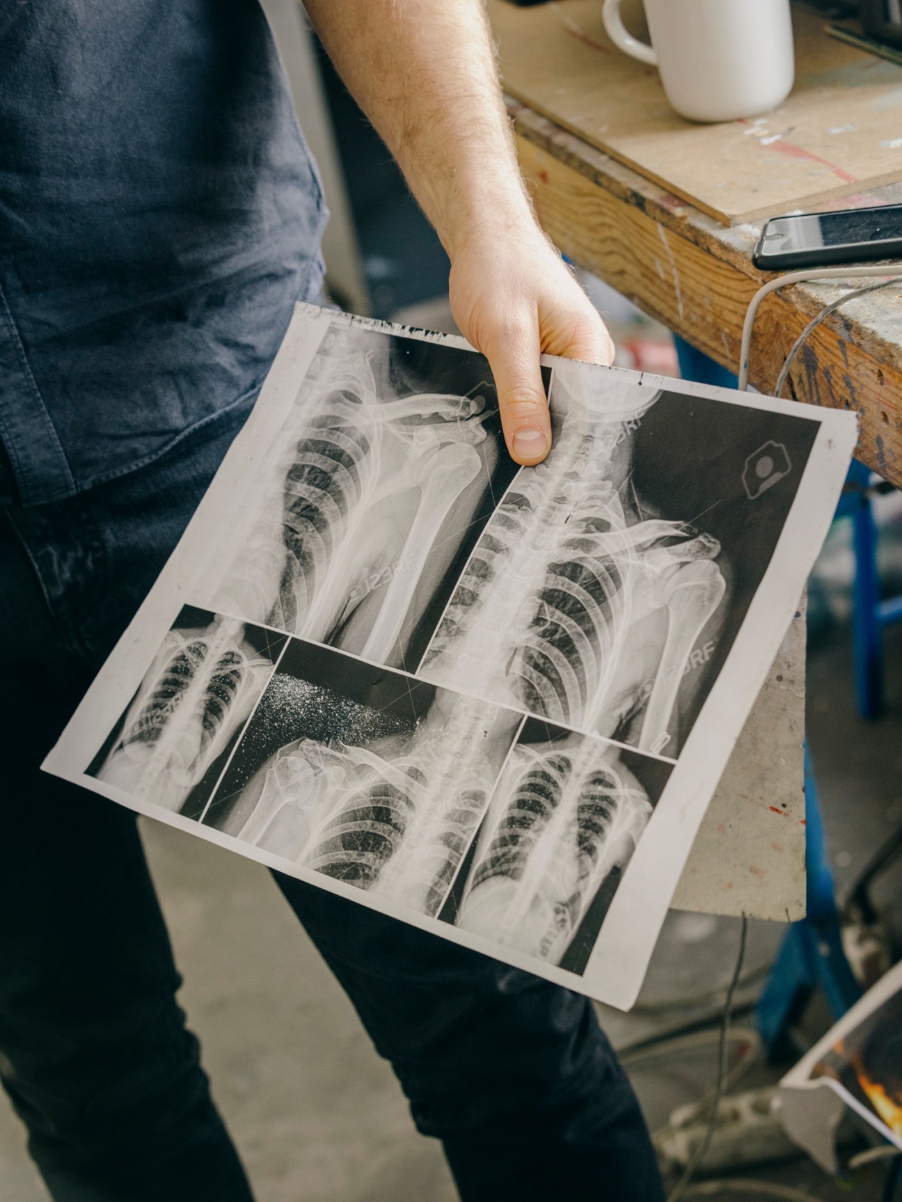 Person examining X-ray medical images on paper at a wooden desk